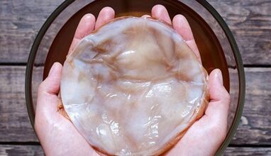Tea fungus for the treatment of fungi on the legs