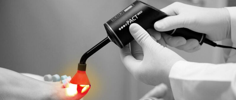 laser treatment for fungus on toenails